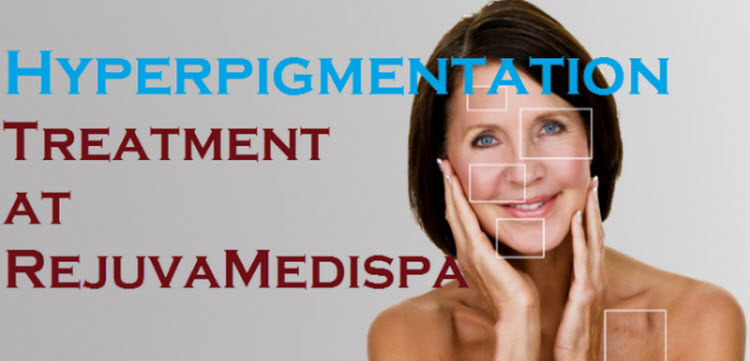 Hyperpigmentation Treatment at RejuvaMedispa, Langley - Rejuva Medispa ...